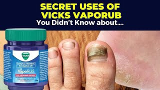 5 Secret Uses of Vicks VapoRub You Didnt Know About [upl. by Eileme]