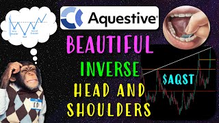 Aquestive Therapeutics Stock AQST BEAUTIFUL Inverse Head and Shoulders [upl. by Abramo]