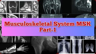 Radiology Viva Cases  7173  Musculoskeletal System Part1  MSK medical radiology ultrasound [upl. by Anaujd]