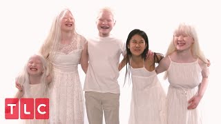 The Grabowskis Unique Adoption Story Part 2  Born With Albinism [upl. by Sayce]