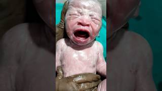 Essential care of new born baby shortsvideo cutebaby newbornarrival newbornbaby [upl. by Nnayllek756]