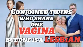 Conjoined twins who share one vagina but one is a LESBIAN [upl. by Mcgraw59]