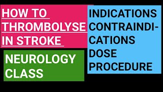 Thrombolysis in acute stroke  indications contraindications dose and procedure [upl. by Enirroc]