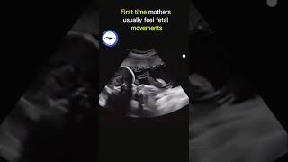 Babys First Powerful Kicks 💕 in womb 💕 Boy or Gir 🥰  Ultrasound pregnancy ultrasound baby [upl. by Fadiman]