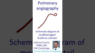 Pulmonary angiography [upl. by Deloris]