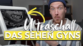 Was ist das Ultraschall in der Schwangerschaft enträtselt I vom Embryo bis zum Baby [upl. by Sekofski]