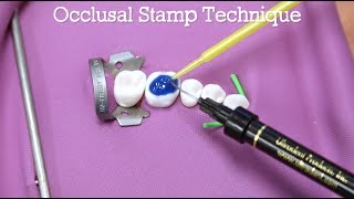 How To Do The Occlusal Stamp Technique [upl. by Sirc]