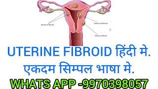 UTERINE FIBROID IN HINDI [upl. by Bilow]