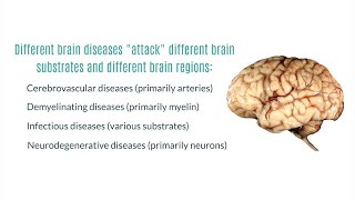 Neurodegenerative Diseases of the Brain [upl. by Toth]