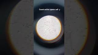 Microscope semen slid cout active cell  and pus cell dmlt patholgy medicalcollegelife foryou [upl. by Redyr]