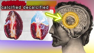 The Secret To Decalcifying The Pineal Gland  HOW TO [upl. by Ainak]