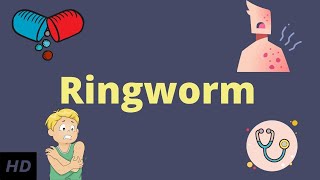 Ringworm Causes Signs and Symptoms Diagnosis and Treatment [upl. by Atiuqram272]