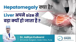 Why does the liver become bigger than its size  What is Hepatomegaly  Dr Aditya Kulkarni [upl. by Ralyks]