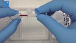 Lysing Fingerstick Whole Blood for MedMira POC Rapid Test [upl. by Largent]