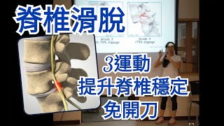 脊椎滑脫，3運動提升脊椎穩定，免開刀【琵塔琪 物理治療師】教學直播 [upl. by Elletnwahs]