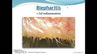 Dry Eye Decoded Webinar [upl. by Notsla]