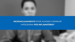 MICROAGULHAMENTO PODE AJUDAR A DIMINUIR HIPOCROMIA PÓS INFLAMATÓRIA [upl. by Eelrahs]