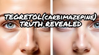 The Shocking truth about Tegretolcarbamazepine [upl. by Adniralc]