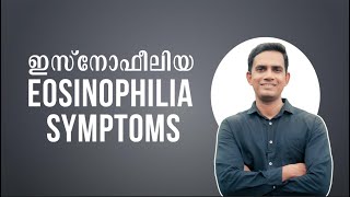 ഇസ്നോഫീലിയ I Eosinophilia symptoms I അലർജി ഉള്ളവർ മാത്രം കാണുക Part 02 [upl. by Namzed]