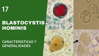 Blastocystis Hominis 17  Blastocistosis  Apicomplexas [upl. by Katzen]