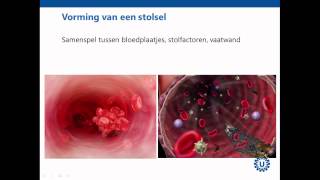 Hemostase deel 1 Inleiding  Prof dr REG Schutgens [upl. by Elly]