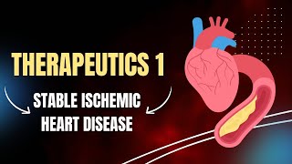 Therapeutics1  stable Ischemic Heart Disease [upl. by Asiaj]