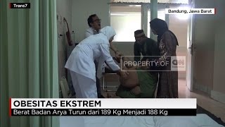 Arya Permana Anak Dengan Obesitas Ekstrem Mendapatkan Terapi Fisik [upl. by Moriyama]