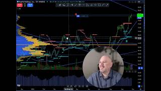 Real Time stock Trading Alerts for dummies That Made Me Profits [upl. by Schaeffer277]