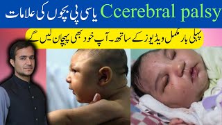 CP cerebral palsy early signs and symptoms  CP bachon ki ilamat  urdu hindi [upl. by Lalo]