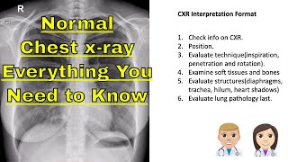 🧑🏽‍⚕️ chest x ray normal Learn The Basics About chest x ray [upl. by Oren]