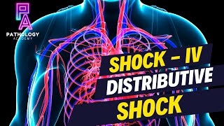 Understanding Distributive Shock  By Dr Aditi Kumar [upl. by Neehsuan57]