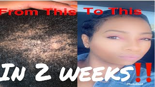 2 Week Hair Growth Routine Hair Growth Tips I WAS BALD SIS‼️ [upl. by Hull683]