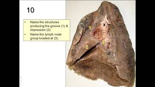 OSPE in anatomy of the respiratory system [upl. by Ainirtac688]