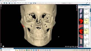 Webinar Orthodontics The best solution for your Ortho treatmentsEnglish [upl. by Naujaj]