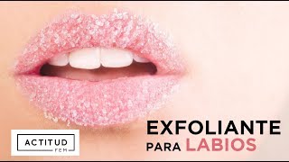 ¿Labios resecos ¡Aquí está la solución rápida y muy barata  ActitudFEM [upl. by Ingaborg]