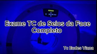 Tc de Seios da Face [upl. by Aiceled]