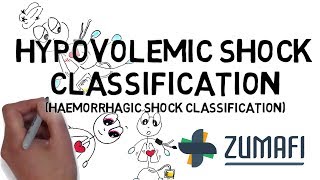 Hypovolemic Shock  Classification [upl. by Hildie]