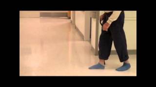 Right Foot Drop in Ambulating Patient  NEJM [upl. by Corly757]