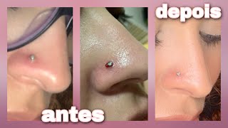 COMO CUIDAR DO PIERCING INFLAMADO  tchau queloide [upl. by Yenreit]