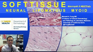 DERMATOPATHOLOGY Soft Tissue Tumors Neural Lipomatous Myoid [upl. by Remas]