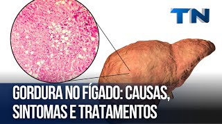 Gordura no fígado causas sintomas e tratamentos  Cuidese Bem [upl. by Scarlett]