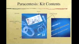 OSCE Paracentesis [upl. by Mureil]