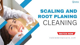 Scaling and Root Planing for Gum Disease [upl. by Mercado925]