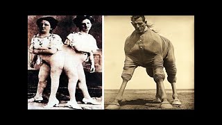 15 Circus Freaks That Actually Existed [upl. by Nileve979]