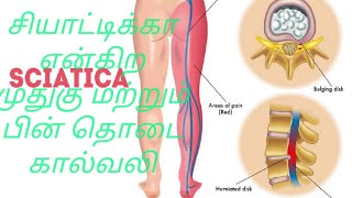 Sciatica Exercise in tamil Back pain in tamilMuthugu valli Back pain exercises in tamilDisc pain [upl. by Drooff462]