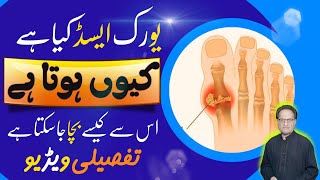 URIC ACID  Kya hai Kyun Hota Hai  Best Remedy  Details Video about URIC ACID  ILAJ Kaysa Karain [upl. by Ecnesse115]