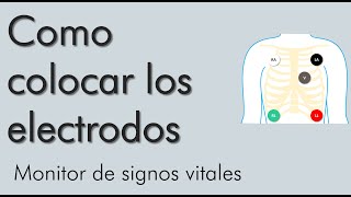 Como colocar los electrodos monitor de signos vitales  video 2 [upl. by Quita794]