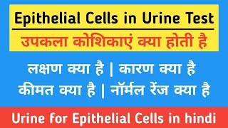 Epithelial Cells in Urine in hindi  Causes Symptoms Price amp Normal Range  उपकला कोशिकाएं क्या है [upl. by Raseac477]