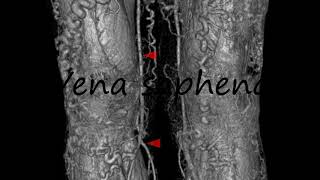 How to Pronounce Vena saphena [upl. by Abshier]