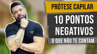 10 PONTOS NEGATIVOS DE USAR PRÓTESE CAPILAR  Você precisa saber disso [upl. by Marc]